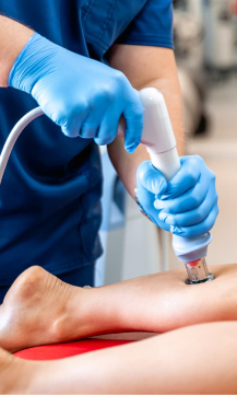 Radiofrequency ablations