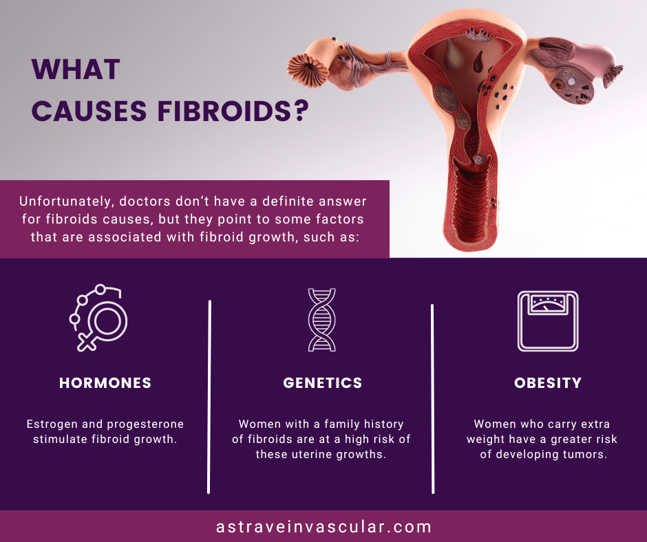 What Causes Fibroids