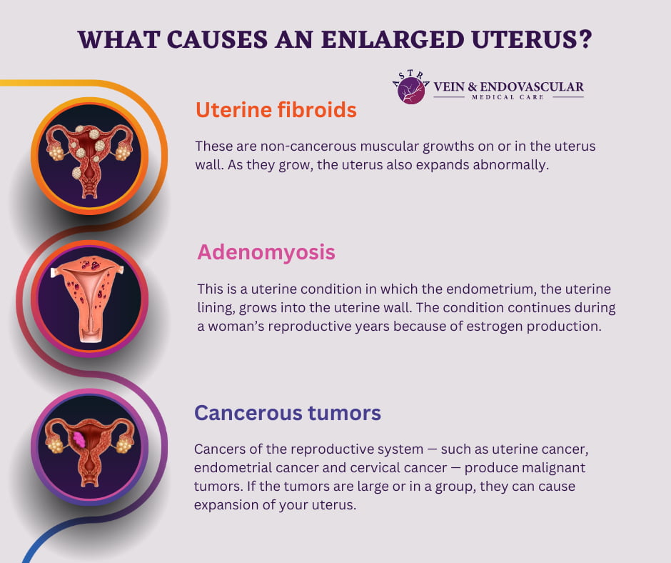 What Causes an Enlarged Uterus