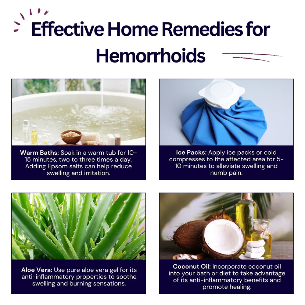Effective Home Remedies for Hemorrhoids